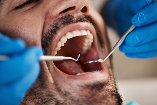 Best Dental Abscess Treatment in Delcambre, LA